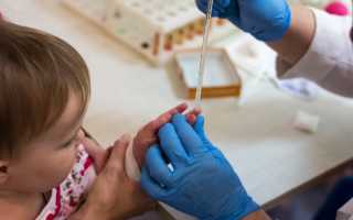 Нормы общего анализа крови у детей – расшифровка результатов анализа