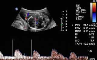 Допплерометрия при беременности: что это, нормы, расшифровка