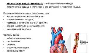 Возможности мультиспиральной компьютерной томографии в диагностике поражения коронарных и периферических артерий