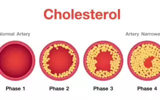 Норма холестерина в крови