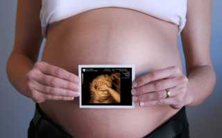 УЗИ во втором триместре беременности: все об исследовании