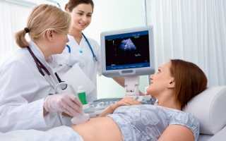 УЗИ в третьем триместре беременности