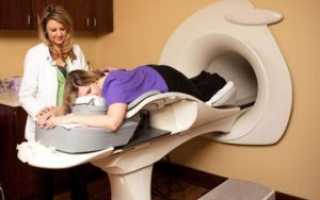 Не опасно ли делать рентгенографию во время менструации