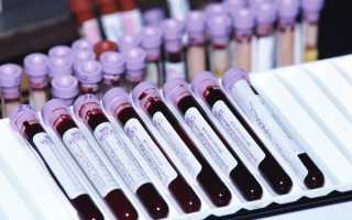 Как понять, бактериальная или вирусная инфекция, по общему анализу крови