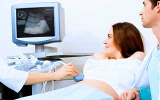 Диагностическое окно счастливых дней скрининга или когда нужно делать УЗИ беременной