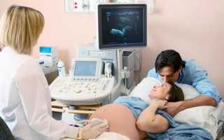Что делать при отслойке плаценты на ранних сроках беременности?
