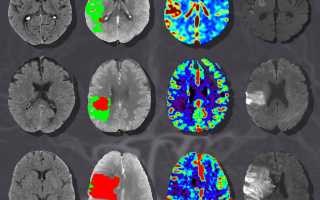 Компьютерная томография (КТ) головного мозга с контрастом