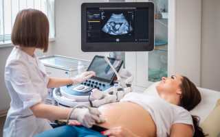 Скрининг первого триместра беременности: нормы, результаты, патологии