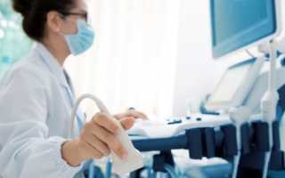 Допплерография – дуплексное исследование артерий и вен