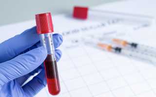 ЭМДС анализ крови: что это, расшифровка