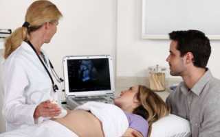 На каком сроке видно беременность на УЗИ