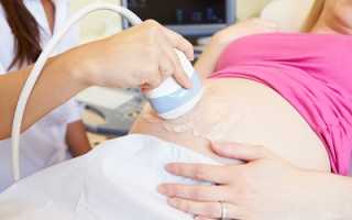 УЗИ на 20-21 неделе беременности: показатели, расшифровка
