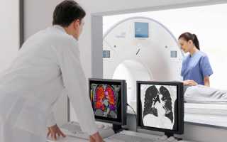Как проводится компьютерная томография легких