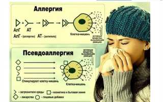 Аллергия или псевдоаллергия