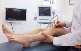 Дуплексное сканирование артерий: показания, подготовка