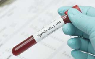 Анализ крови на сифилис