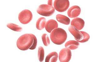 Гипохромия в общем анализе крови: это рак или нет