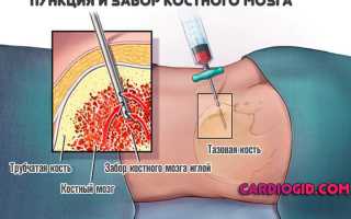 Что показывает анализ крови на сывороточное железо