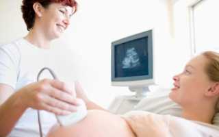 Цели УЗИ на 32 неделе беременности