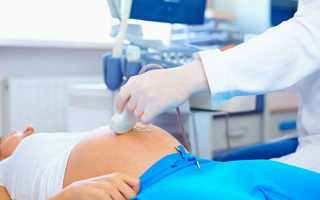 УЗИ при беременности: как часто можно делать