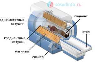 Разница между МРТ или СКТ