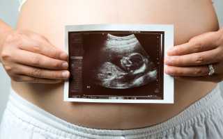 Сколько УЗИ во время беременности необходимо