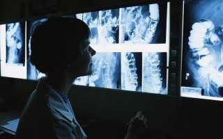 Устройство и принцип работы рентгеновского аппарата